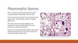Flooret Cells Comprehensive Overview of Lipoma: Types, Diagnosis, and Treatment | PPTX