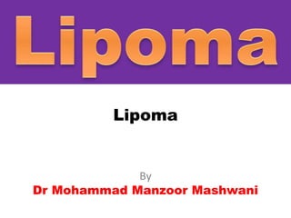 Lipoma
By
Dr Mohammad Manzoor Mashwani
 