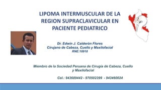 LIPOMA INTERMUSCULAR DE LA
REGION SUPRACLAVICULAR EN
PACIENTE PEDIATRICO
Dr. Edwin J. Calderón Flores
Cirujano de Cabeza, Cuello y Maxilofacial
RNE:18918
Miembro de la Sociedad Peruana de Cirugía de Cabeza, Cuello
y Maxilofacial
Cel.: 943689442 - 970502399 - 943460024
 