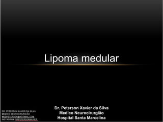 Lipoma medular
Dr. Peterson Xavier da Silva
Medico Neurocirurgião
Hospital Santa Marcelina
 