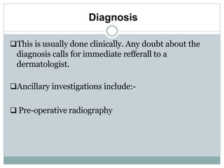 Diagnosis
This is usually done clinically. Any doubt about the
diagnosis calls for immediate refferall to a
dermatologist.
Ancillary investigations include:-
 Pre-operative radiography
 