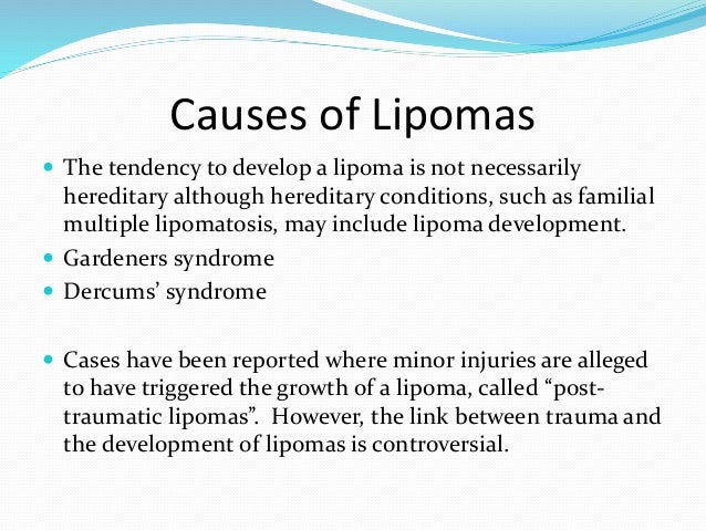 Lipoma - Wikipedia