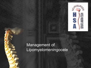 Management of
Lipomyelomeningocele
 