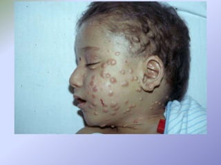 O Farmacêutico nunca deverá propor mudanças no curso do tratamento da doença. Caso esteja definitivamente convencido de que o paciente não esta recebendo um tratamento satisfatório é seu dever orienta-lo a procurar outro médico.ESTRATÉGIAS DO FARMACÊUTICO NO ATENDIMENTO AO PACIENTE DISLIPIDÊMICOO Farmacêutico deve estar consciente de que o tratamento do PD é individual. *  para cada paciente o tipo de hipolipemiante, dose, horário de administração pode ser diferente. * Para um mesmo paciente a forma de tratamento não é fixa podendo existir modificações em função do agravamento ou abrandamento da doença.* Estas orientações devem ser transmitidas em especial aos atendentes que por não terem  consciência da complexidade da doença, se sentem se a vontade para proporem modificações à orientação médica. Cabe ao Farmacêutico "por ordem na casa", educando seus auxiliares a prestarem um bom atendimento ao PD.