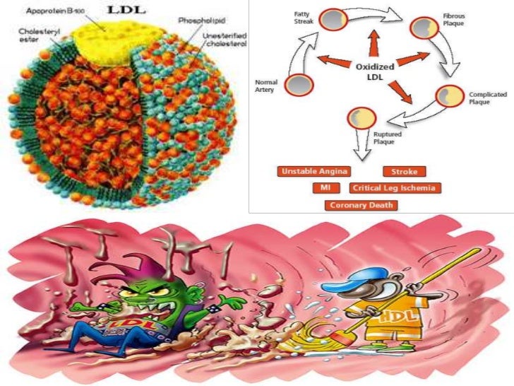 LDL lipoproteinas de Baja Densidad