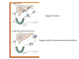 Soggetto normale




Soggetto affetto da ipercolesterolemia familiare
 