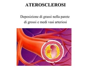 ATEROSCLEROSI

Deposizione di grassi nella parete
  di grossi e medi vasi arteriosi
 