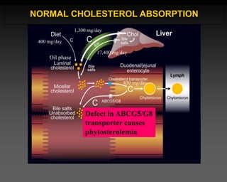 400 mg/day
1,300 mg/day
17,400 mg/day
850 mg/day
NORMAL CHOLESTEROL ABSORPTION
Defect in ABCG5/G8
transporter causes
phytosterolemia
Oil phase
 