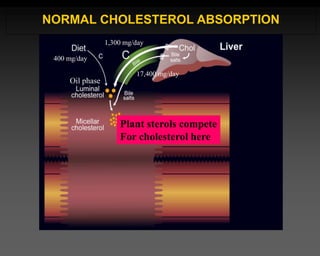 400 mg/day
1,300 mg/day
17,400 mg/day
NORMAL CHOLESTEROL ABSORPTION
Plant sterols compete
For cholesterol here
Oil phase
 