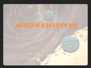 ARTERIOESCLEROSIS
 