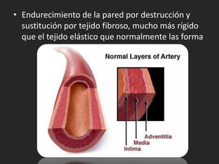 • Endurecimiento de la pared por destrucción y
  sustitución por tejido fibroso, mucho más rígido
  que el tejido elástico que normalmente las forma
 