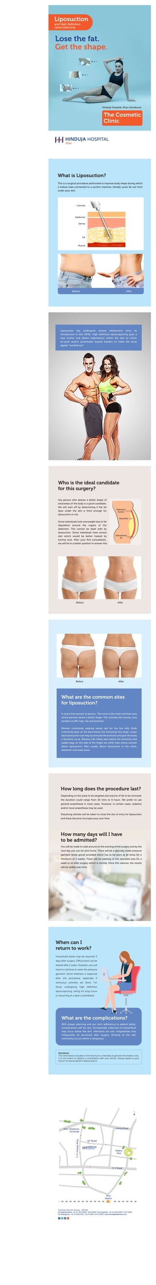 LiposuctionLiposuction: Lose fat. Get the shape.