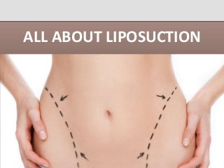 ALL ABOUT LIPOSUCTION
 