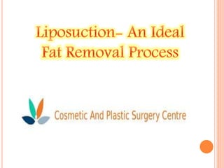 A Brief About Liposuction