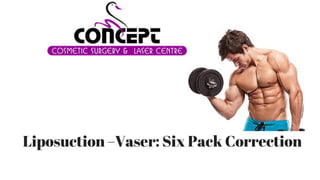 Liposuction –Vaser: Six Pack Correction
 