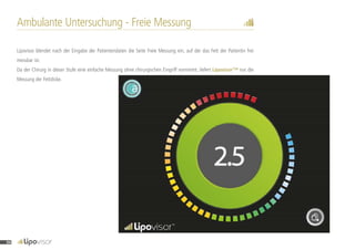 Ambulante Untersuchung - Freie Messung
Lipovisor blendet nach der Eingabe der Patientendaten die Seite Freie Messung ein, auf der das Fett der Patientin frei
messbar ist.
Da der Chirurg in dieser Stufe eine einfache Messung ohne chirurgischen Eingriff vornimmt, liefert Lipovisor™ nur die
Messung der Fettdicke.
94
 