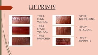 LIP PRINTS
• TYPE I-
LONG
VERTICAL
• TYPE I’-
SHORT
VERTICAL
• TYPEII -
BRANCHED
• TYPE III-
INTERSECTING
• TYPE IV-
RETICULATE
• TYPE V-
INDEFINITE
 