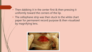 • Then dabbing it in the center first & then pressing it
uniformly toward the corners of the lip.
• The cellophane strip was then stuck to the white chart
paper for permanent record purpose & then visualized
by magnifying lens.
 