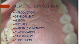RUGAE PATTERN C0NTENT
INTRODUCTION
DEVELOPMENT
HISTORY
FEATURES
MATERIALS & METHODS
CLASSIFICATION
CASE HISTORY
CONCLUSION
 
