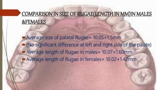 COMPARISON IN SIZE OF RUGAE(LENGTH IN MM)IN MALES
&FEMALES
Average size of palatal Rugae= 10.05+1.5mm
(No significant difference at left and right side of the palate)
Average length of Rugae in males= 10.07+1.60mm
Average length of Rugae in females= 10.02+1.42mm
 