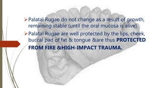 Palatal Rugae do not change as a result of growth,
remaining stable (until the oral mucosa is alive).
Palatal Rugae are well protected by the lips, cheek,
buccal pad of fat & tongue &are thus PROTECTED
FROM FIRE &HIGH-IMPACT TRAUMA.
 