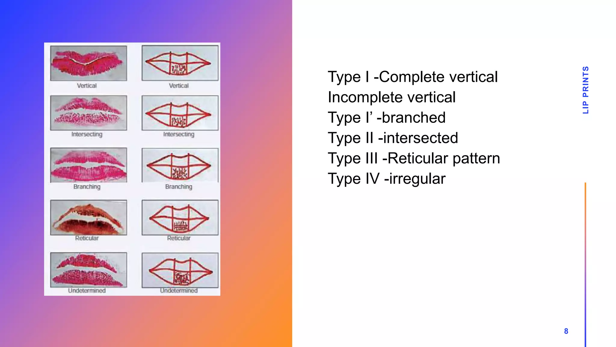 Type I -Complete vertical
Incomplete vertical
Type I’ -branched
Type II -intersected
Type III -Reticular pattern
Type IV -irregular
LIP
PRINTS
8
 