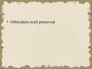 • Orbicularis oculi preserved
 