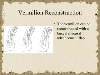 Vermilion Reconstruction
             • The vermilion can be
               reconstructed with a
               buccal mucosal
               advancement flap
 