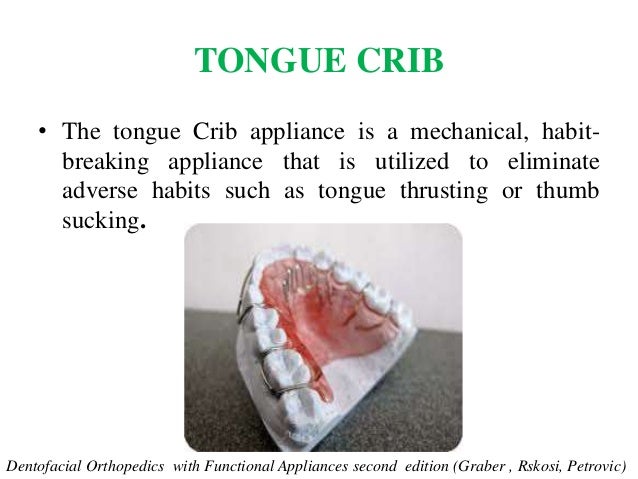Lip Bumper Quad Helix Tongue Crib Tpa Nance By Dr Saurav Mishra