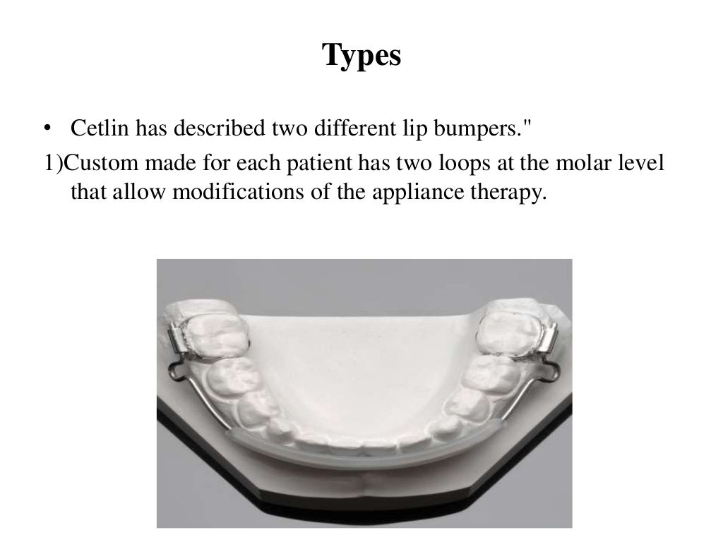 Lip bumper, quad helix, tongue crib,Tpa,Nance by Dr.Saurav Mishra