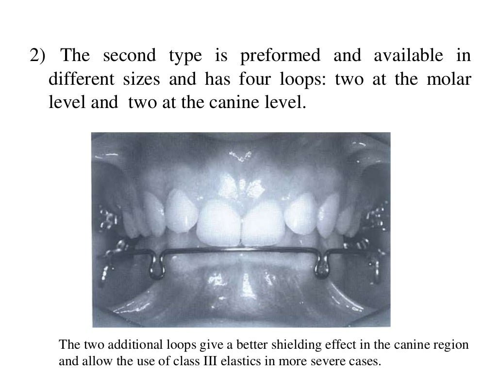 Lip bumper, quad helix, tongue crib,Tpa,Nance by Dr.Saurav Mishra