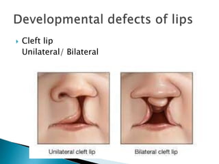 Lips tongue and palate | PPTX