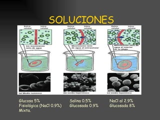SOLUCIONES Glucosa 5% Fisiológica (NaCl 0.9%) Mixta. Salina 0.5% Glucosada 0.9% NaCl al 2.9% Glucosada 8% a 