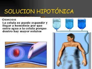 SOLUCION HIPOTÓNICA 