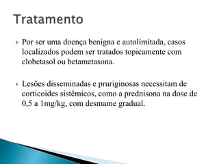  Por ser uma doença benigna e autolimitada, casos
localizados podem ser tratados topicamente com
clobetasol ou betametasona.
 Lesões disseminadas e pruriginosas necessitam de
corticoides sistêmicos, como a prednisona na dose de
0,5 a 1mg/kg, com desmame gradual.
 