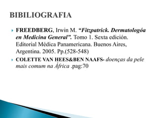  FREEDBERG, Irwin M. “Fitzpatrick. Dermatologóa
en Medicina General”. Tomo 1. Sexta edición.
Editorial Médica Panamericana. Buenos Aires,
Argentina. 2005. Pp.(528-548)
 COLETTE VAN HEES&BEN NAAFS- doenças da pele
mais comum na África .pag:70
 