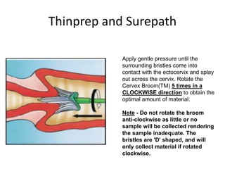 Thinprep and Surepath
Apply gentle pressure until the
surrounding bristles come into
contact with the ectocervix and splay
out across the cervix. Rotate the
Cervex Broom(TM) 5 times in a
CLOCKWISE direction to obtain the
optimal amount of material.
Note - Do not rotate the broom
anti-clockwise as little or no
sample will be collected rendering
the sample inadequate. The
bristles are 'D' shaped, and will
only collect material if rotated
clockwise.
 