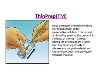 ThinPrep(TM)
Once collected, immediately rinse
the 'broom-head' in the
preservative solution. This is best
achieved by pushing the broom into
the base of the vial 10 times,
forcing the bristles apart. Finally,
swirl the brush vigorously to
release any trapped material and
further break down the previoulsy
released material
 