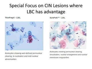 Special Focus on CIN Lesions where
LBC has advantage
 
