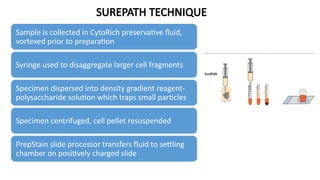 Cytorich Comprehensive Overview of Liquid Based Cytology and Its Clinical ...
