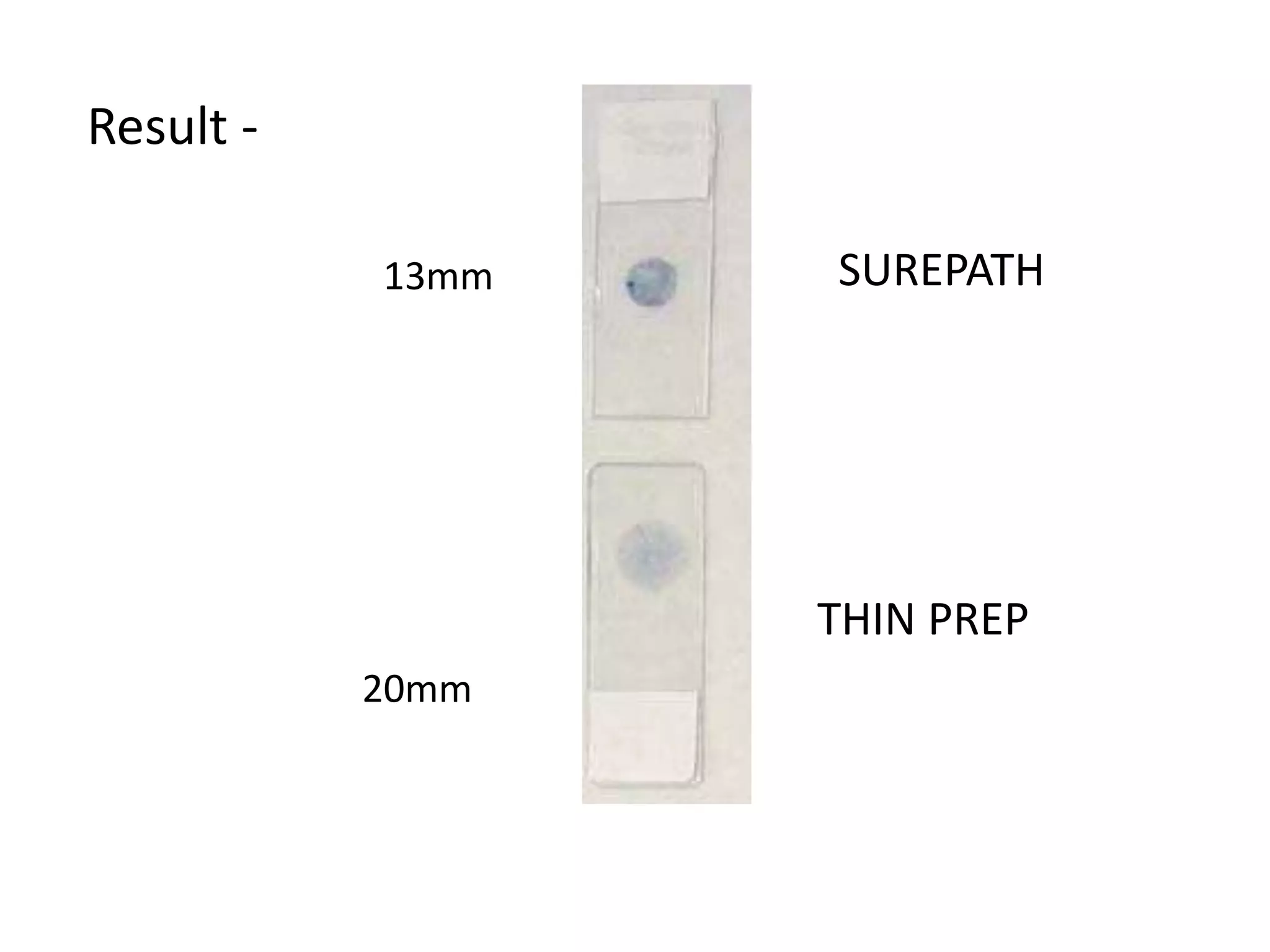 13mm
20mm
SUREPATH
THIN PREP
Result -
 