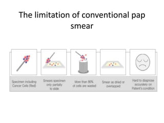The limitation of conventional pap
smear
 