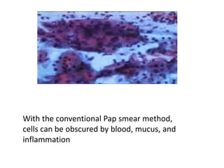 With the conventional Pap smear method,
cells can be obscured by blood, mucus, and
inflammation
 