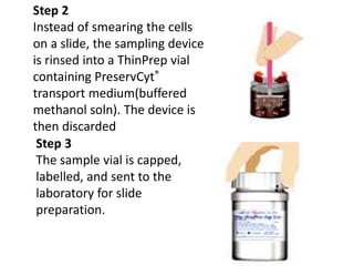Step 2
Instead of smearing the cells
on a slide, the sampling device
is rinsed into a ThinPrep vial
containing PreservCyt®
transport medium(buffered
methanol soln). The device is
then discarded
Step 3
The sample vial is capped,
labelled, and sent to the
laboratory for slide
preparation.
 