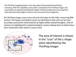 The ThinPrep Imaging System is the only system that provides Dual Review
screening. With this capability, every slide is analyzed by the ThinPrep Imager and
screened by an experienced cytotechnologist, thereby combining human expertise
with advanced technology to achieve more accurate clinical diagnoses.
the ThinPrep Imager scans every cell and cell cluster on the slide, measuring DNA
content. The largest and darkest nuclei are identified so that cells can be more
accurately assessed for abnormalities by highly skilled cytotechnologists. Cells of
interest are highlighted for cytotechnologists' review, helping them to better focus
their interpretive skills where it counts most
The area of interest is shown
in the "crux" of the L-shape
when identified by the
ThinPrep Imager
 