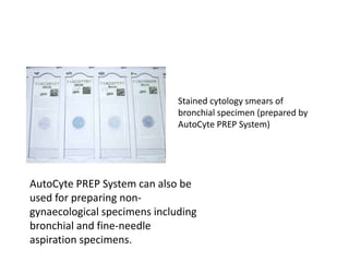 AutoCyte PREP System can also be
used for preparing non-
gynaecological specimens including
bronchial and fine-needle
aspiration specimens.
Stained cytology smears of
bronchial specimen (prepared by
AutoCyte PREP System)
 