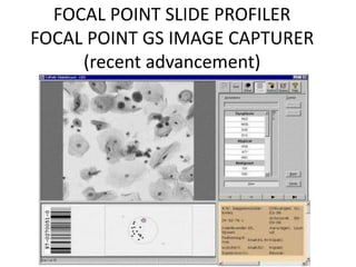 FOCAL POINT SLIDE PROFILER
FOCAL POINT GS IMAGE CAPTURER
(recent advancement)
 