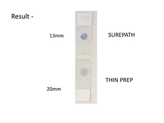 13mm
20mm
SUREPATH
THIN PREP
Result -
 