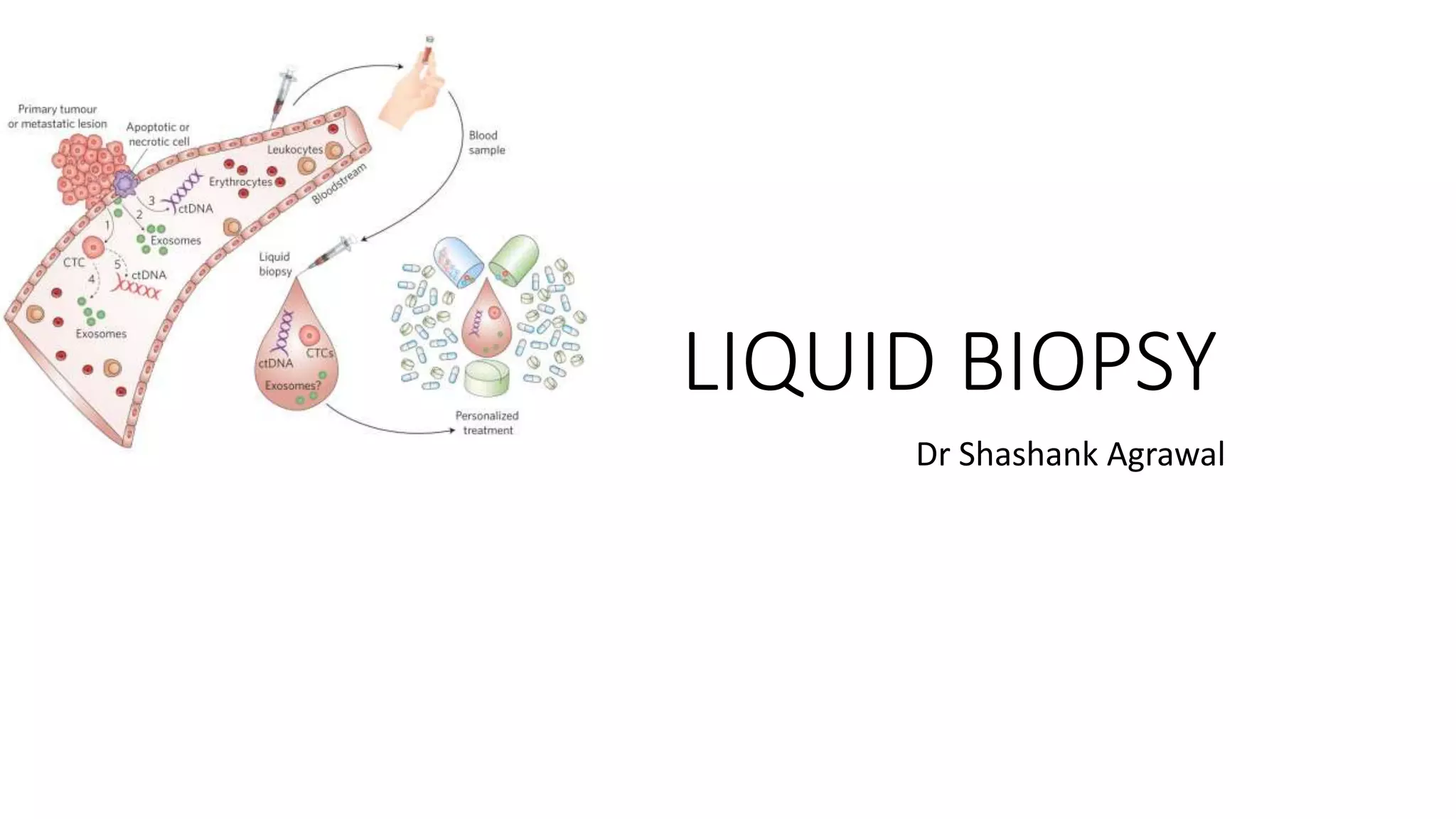 LIQUID BIOPSY
Dr Shashank Agrawal
