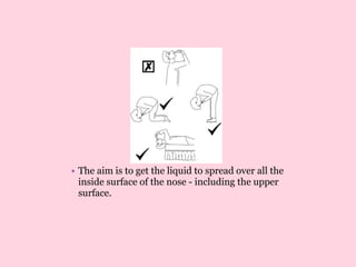 • The aim is to get the liquid to spread over all the
inside surface of the nose - including the upper
surface.
 